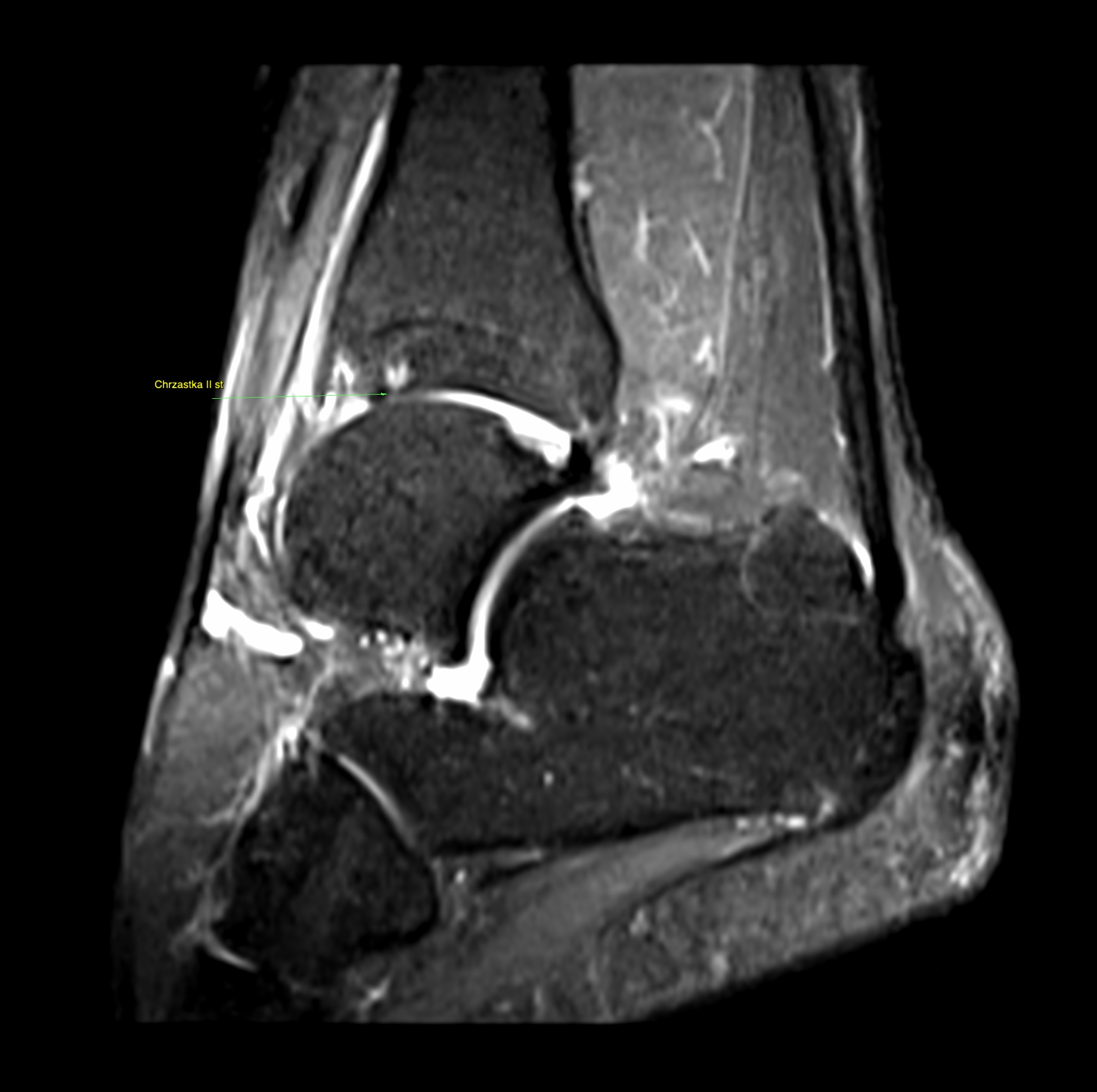 Key image 1