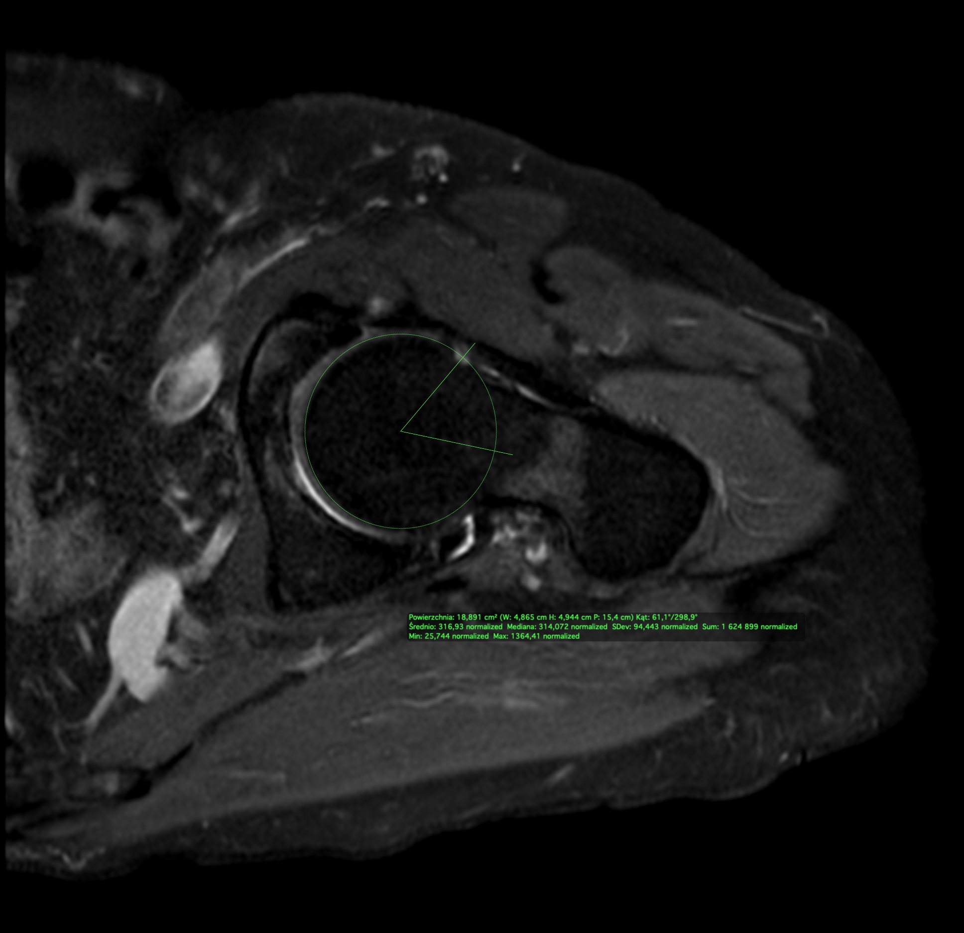 Key image 1